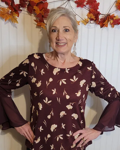 Caroline after ESG Stomach Tightening