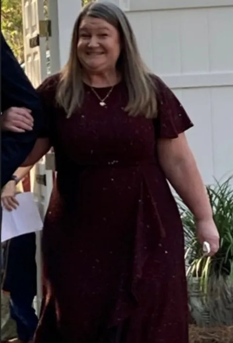 Danna before ESG Stomach Tightening