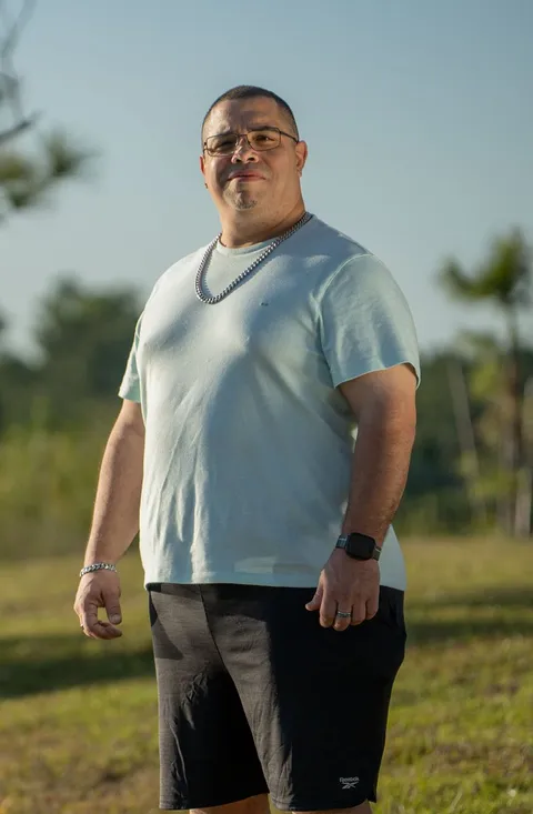 Oscar after ESG Stomach Tightening