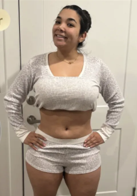 Ruxibeth after a gastric balloon