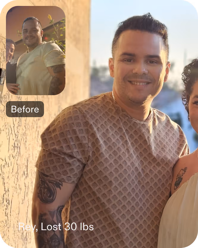 Before and after images of Rey who lost 30 pounds in 5 weeks after an ESG procedure with Everself