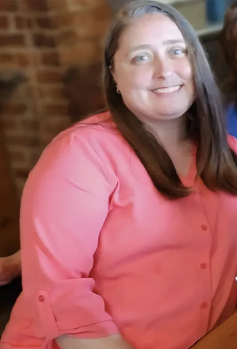 Helen before ESG Stomach Tightening