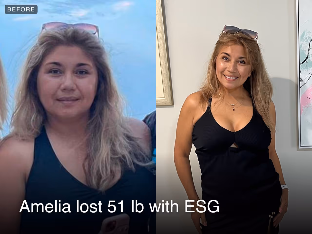 Before and after image of Amelia who lost 51 lbs with ESG