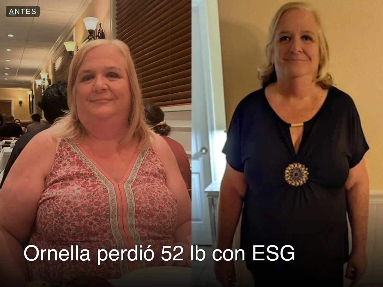Ornella