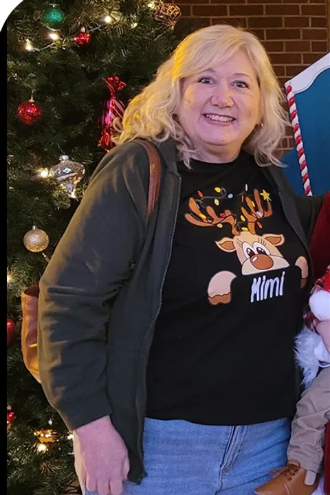 Caroline before ESG Stomach Tightening