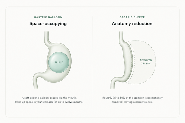 Comparison of a gastric balloon and gastric sleeve weight-loss procedure.