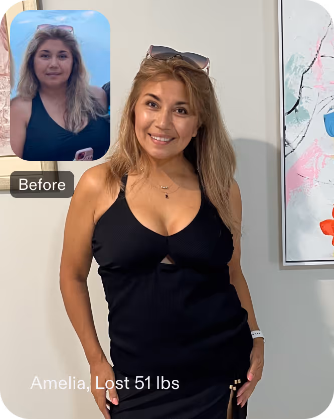Before and after image of Amelia who lost 51 lbs with ESG