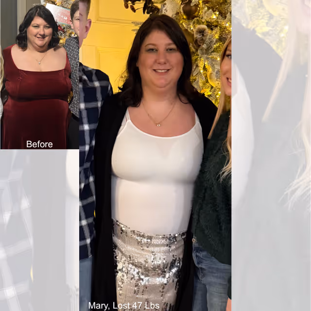 Before and after image of Mary who lost 47 lbs in 2 months with ESG
