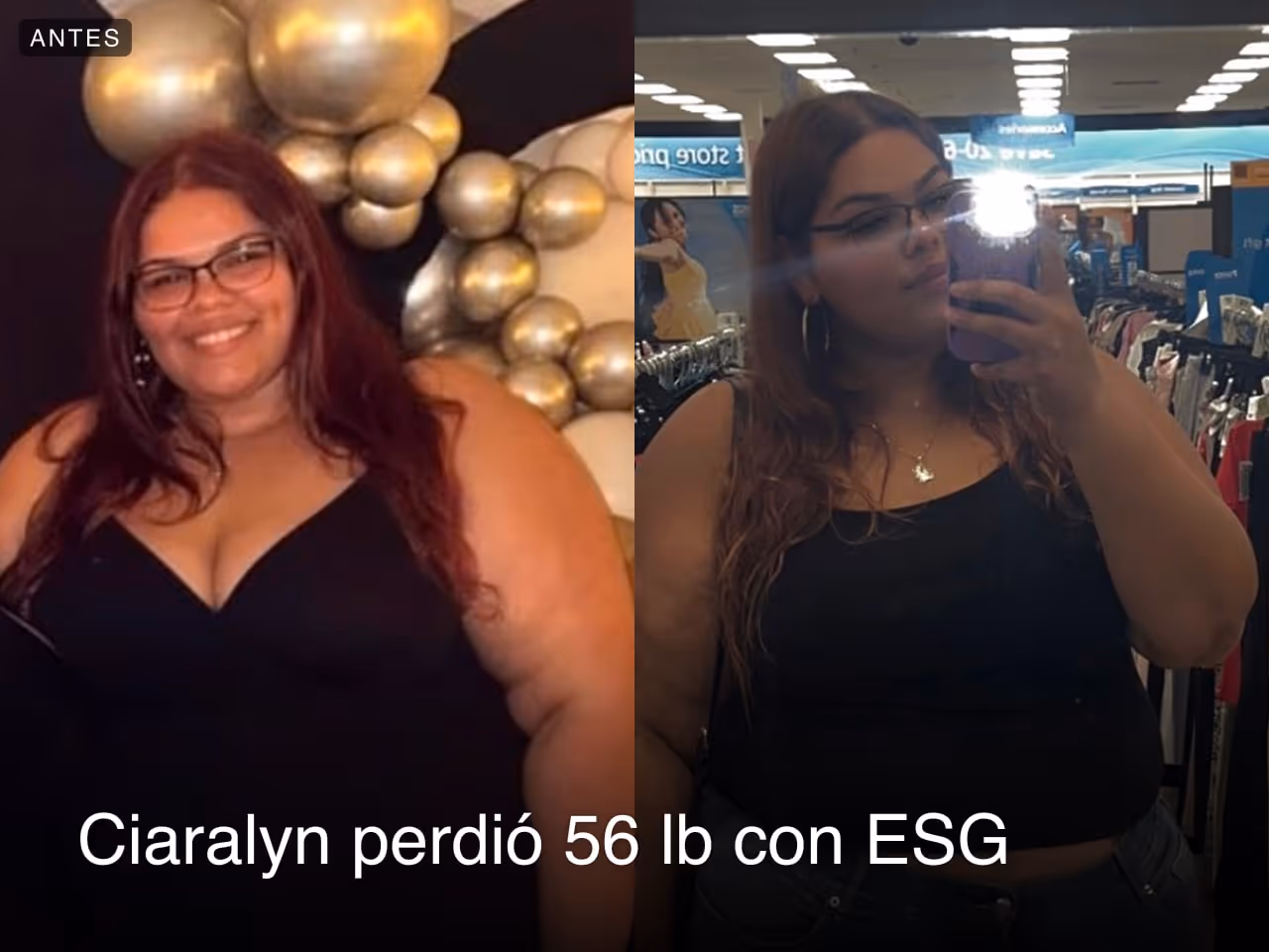 Ciaralyn lost 56 pounds with an ESG from Everself