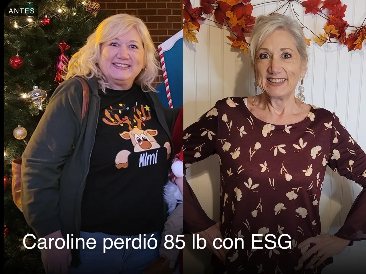 Caroline