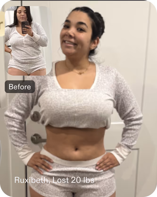 Before and after image of Ruxibeth who lost 20 pounds in 4 months with a gastric balloon procedure