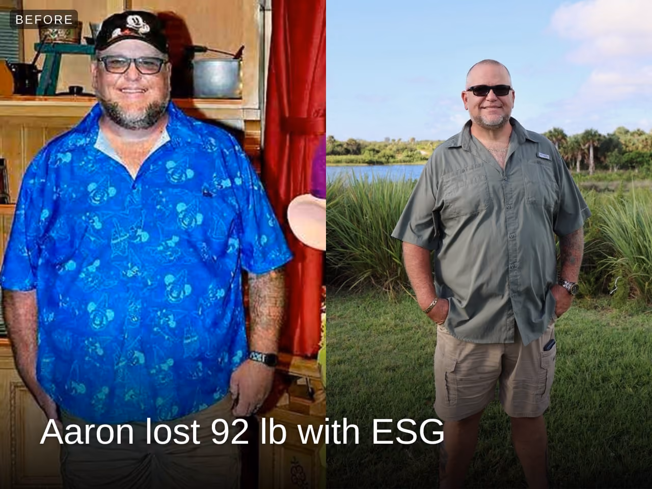 Before and after image of Aaron who lost 92 lbs in 4 months with ESG
