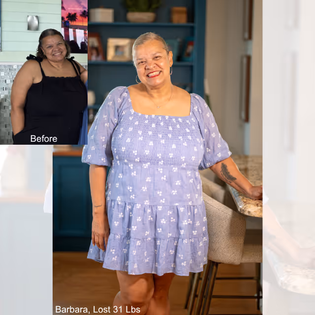 Imagen de antes y después de Barbara, quien perdió 31 libras en 4 meses con ESG