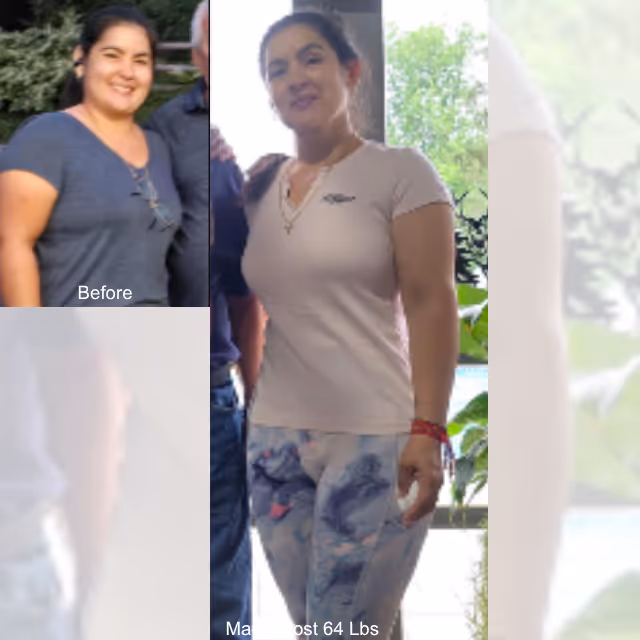 Imagen de antes y después de Maria, quien perdió 64 libras en 12 meses con ESG