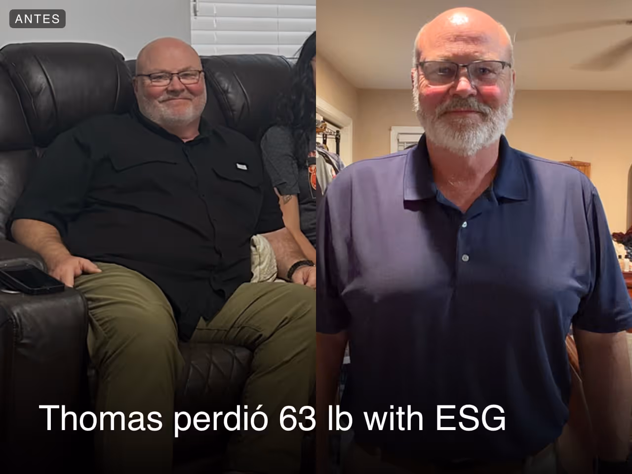 Imagen de antes y después de Thomas, quien perdió 63 libras en 4 meses con ESG