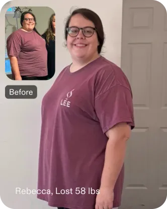 Rebecca lost 58 pounds and transformed her quality of life with ESG