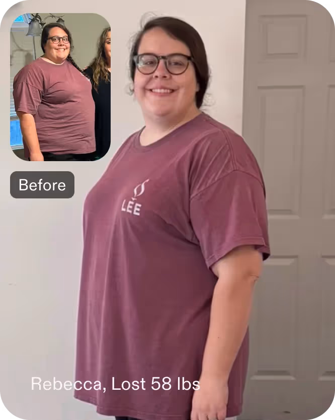 Before and after images of Rebecca who lost 58 pounds with an ESG procedure