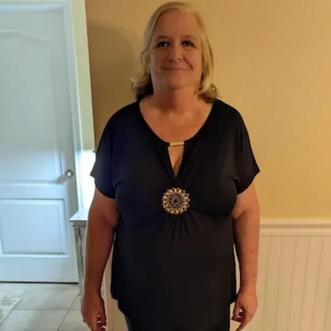 Ornella after ESG Stomach Tightening