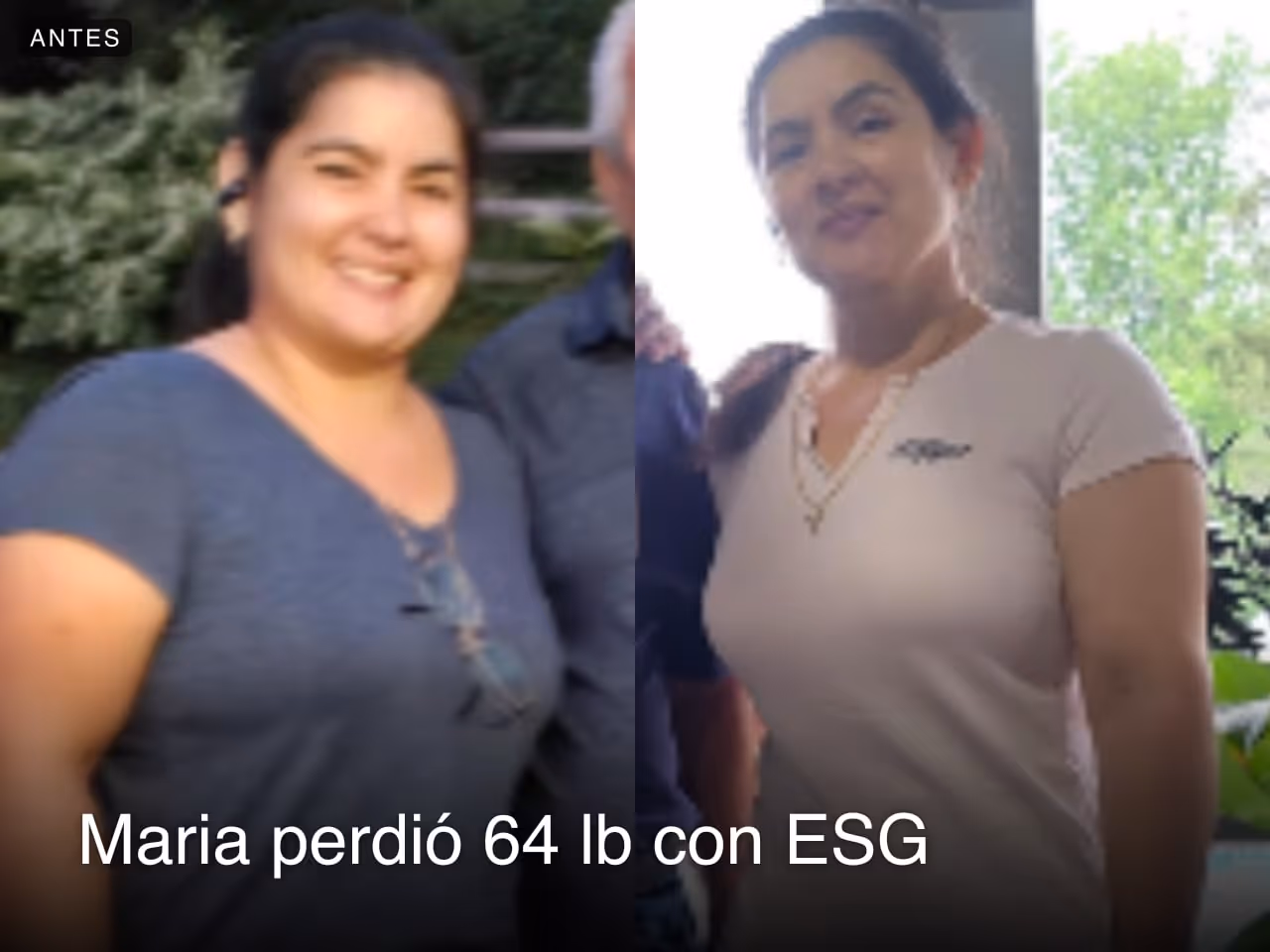 Imagen de antes y después de Maria, quien perdió 64 libras en 12 meses con ESG