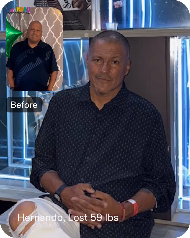Before and after images of Hernando who lost 59 pounds in 3 months after a ESG procedure with Everself