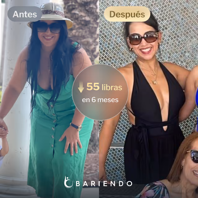 Imágenes de antes y después de Anaís, quien perdió 55 libras en 6 meses tras un balón gástrico con Everself.