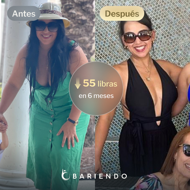 Imágenes de antes y después de Anaís, quien perdió 55 libras en 6 meses tras un balón gástrico con Everself.