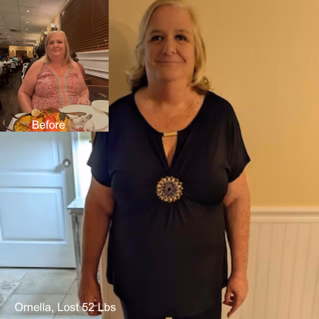 Before and after image of Ornella who lost 52 lbs in 5 months with ESG