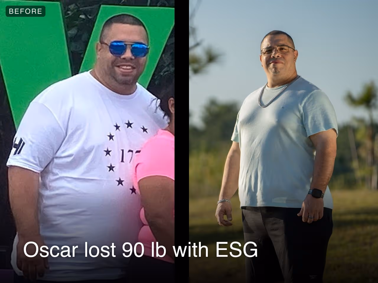 Before and after images of Oscar who lost 90 pounds in 6 months through Everself's ESG Stomach Tightening® procedure