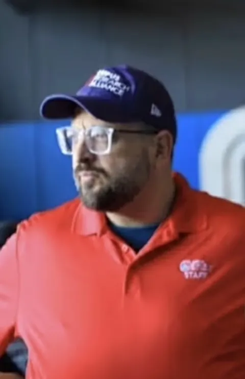 Joey before ESG Stomach Tightening