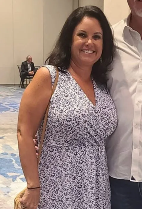 Nikki before ESG Stomach Tightening