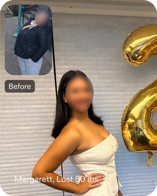 Before and after images of Margarett , a Everself Gastric Balloon patient who lose 50 pounds in 5 months