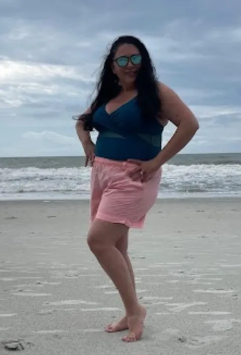 Aminah before ESG Stomach Tightening