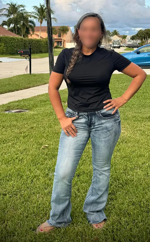Diana after ESG Stomach Tightening