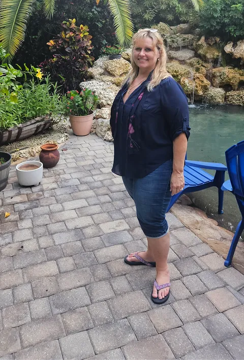 Lisa after ESG Stomach Tightening