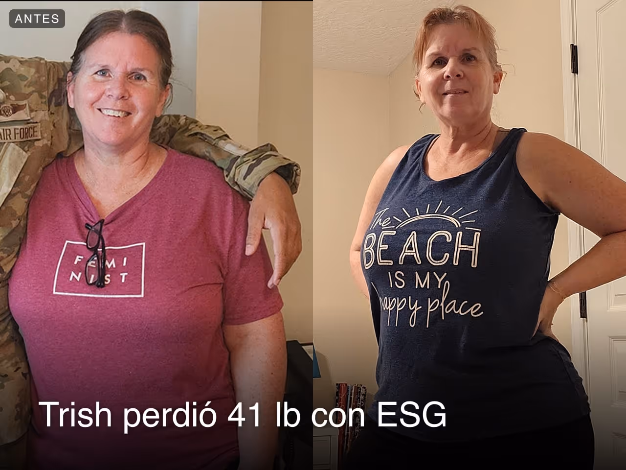 Trish perdió 41 libras después de una ESG con Everself