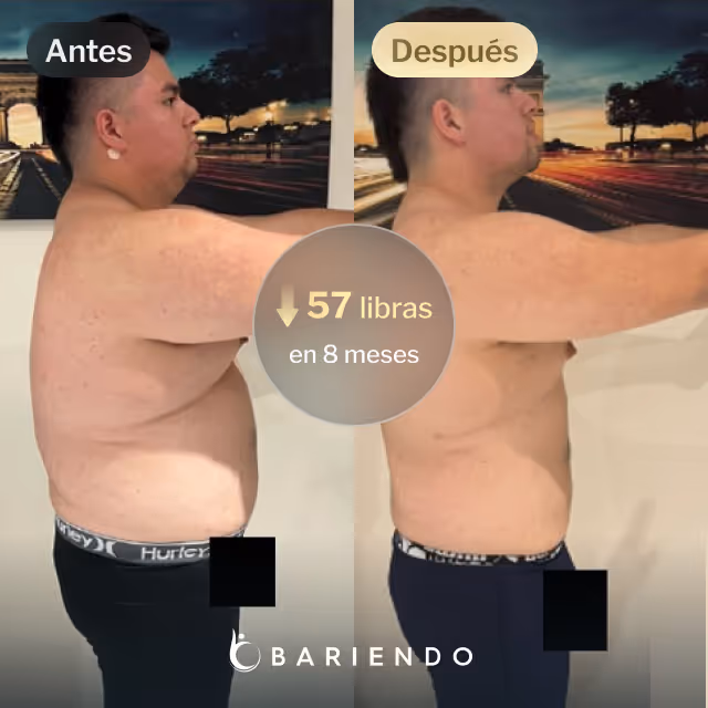 Imágenes de antes y después de Javier que perdió 57 libras en 8 meses después de un procedimiento ESG