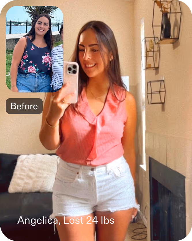 Before and after images of Angelica who lost 24 pounds in 3 months after a ESG procedure with Everself
