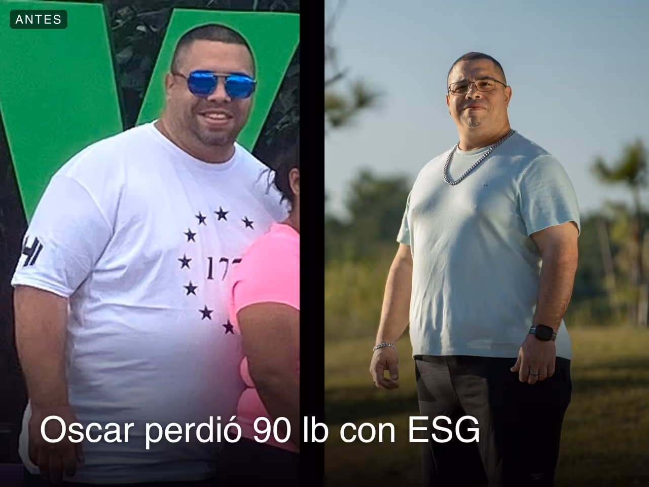 Imágenes de antes y después de Oscar, quien perdió 90 libras en 6 meses a través del procedimiento de Reducción de Estómago ESG de Everself.