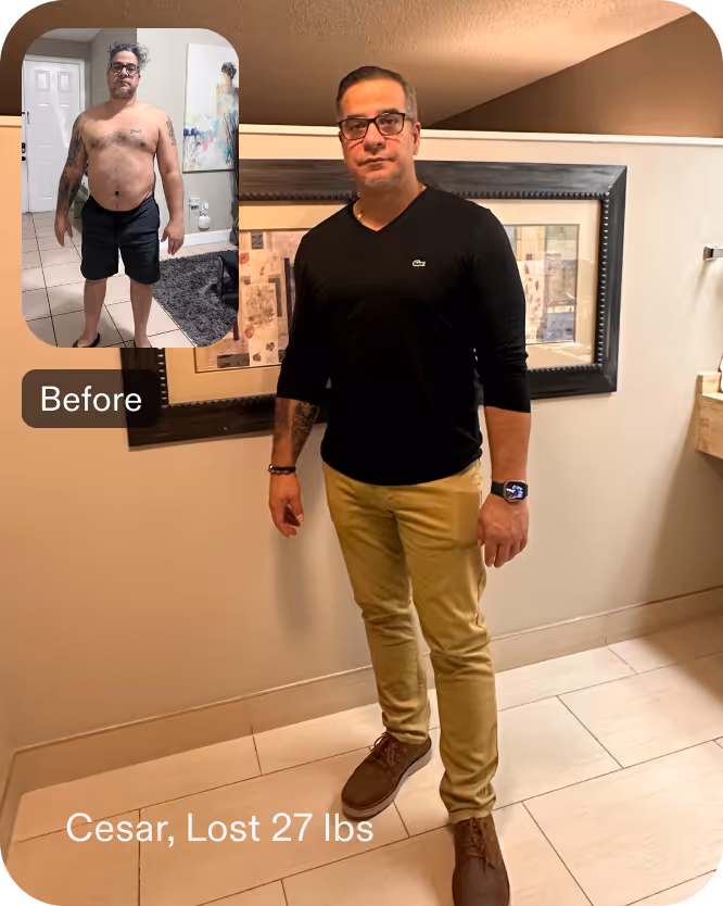 Before and after images of Cesar who lost 27 pounds in 1 month through Everself's ESG Stomach Tightening® procedure