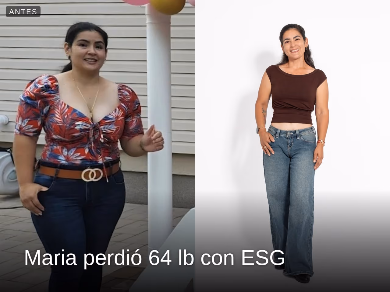 Imagen de antes y después de Maria, quien perdió 64 libras en 12 meses con ESG