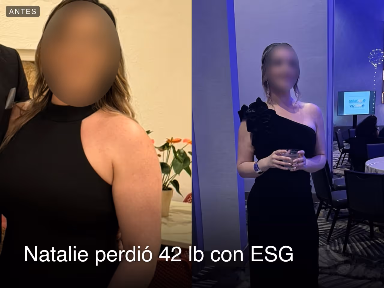 Imágenes de antes y después de Natalie, quien perdió 42 libras en 7 meses después de un procedimiento de Reducción de Estómago ESG con Everself