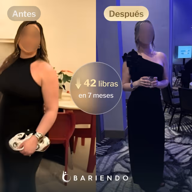 Imágenes de antes y después de Natalie, quien perdió 42 libras en 7 meses después de un procedimiento de Reducción de Estómago ESG con Everself