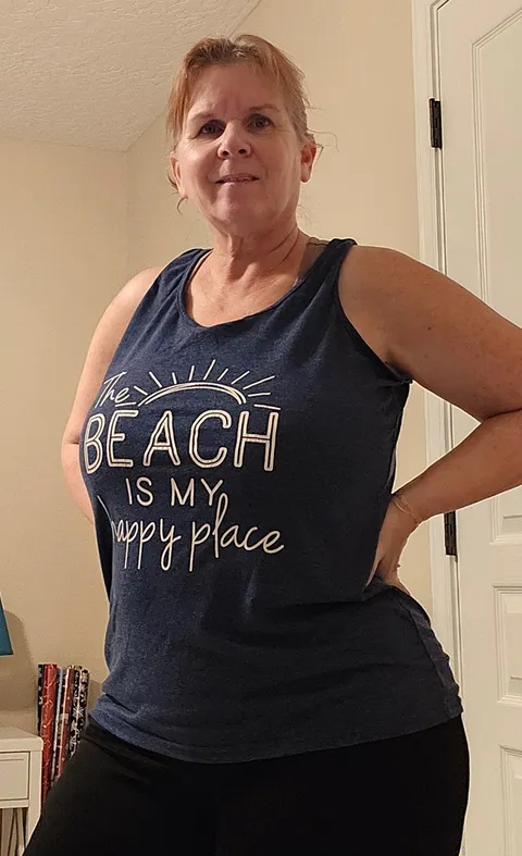 Trish after ESG Stomach Tightening