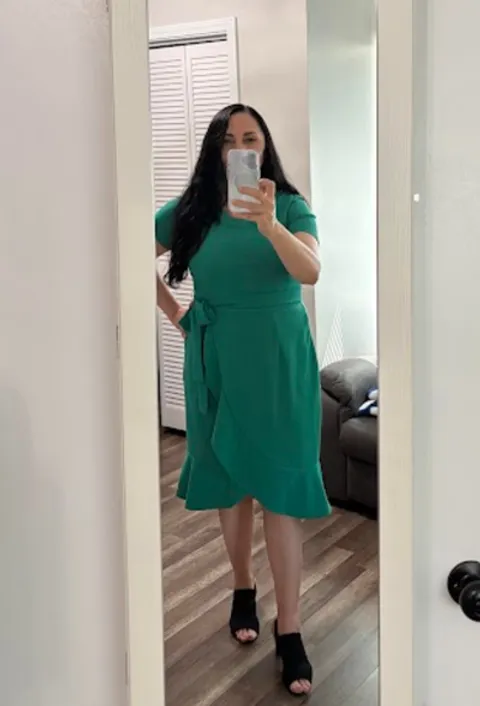 Aminah after ESG Stomach Tightening