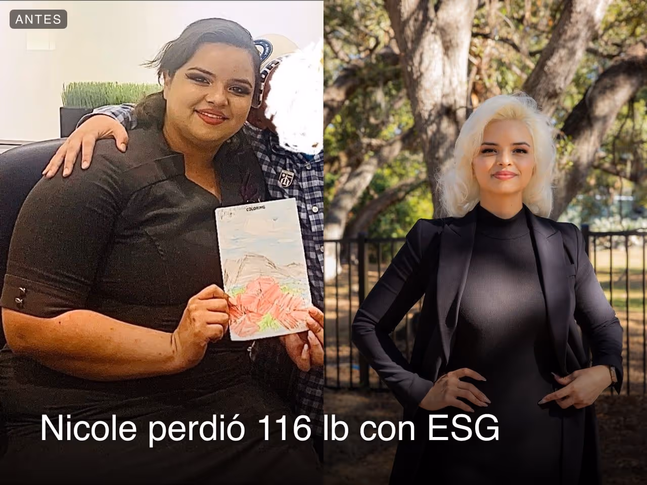 Imágenes de antes y después de Nicole, una paciente de Everself ESG que se endurece el estómago y que pierde 77 libras en 7 meses
