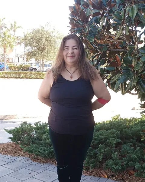 Doris after ESG Stomach Tightening