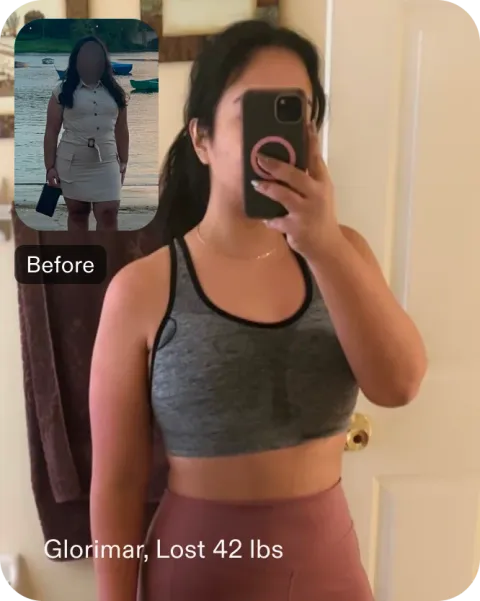 Glorimar before and after