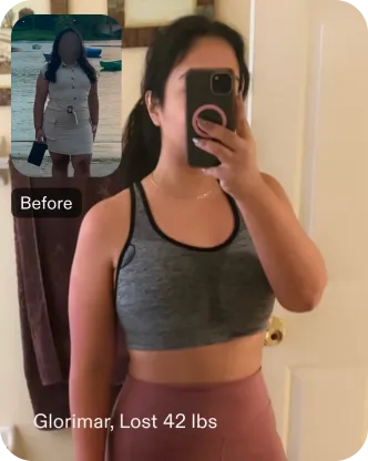 Glorimar lost 43 pounds and continues to thrive with gastric balloon support