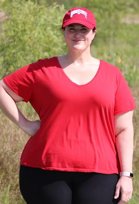 Michelle before TORe gastric bypass revision
