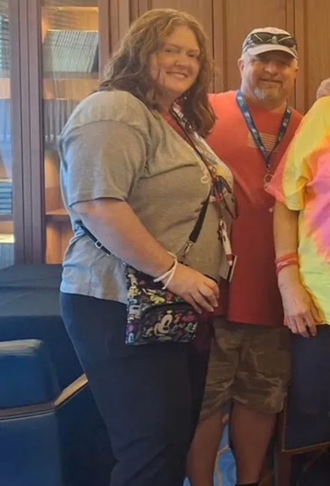 Amanda before ESG Stomach Tightening